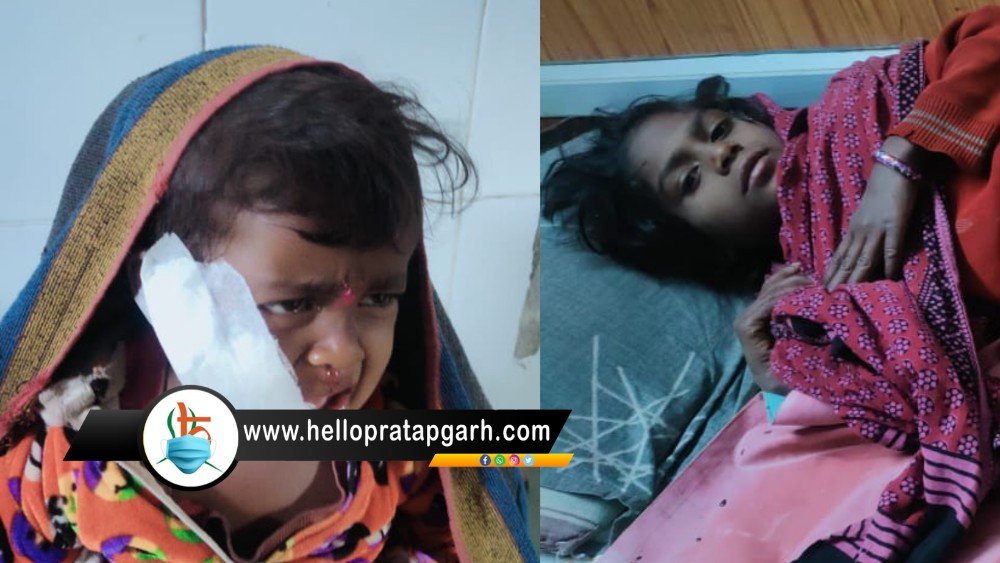 अरनोद : सियार के हमले से मासूम घायल, गंभीर रूप से घायल तीन बच्चों को जिला अस्पताल किया रेफर